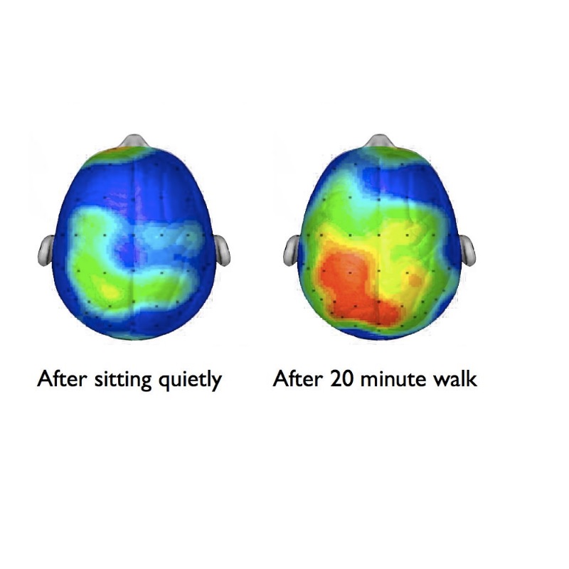Bilde av varmeutslag i hjernen der man ser illustrasjoner av to hoder og viser forskjell på hjerneaktivitet.
